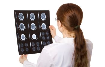 Doctor Looking at X Ray of Brain Injury Charleston SC